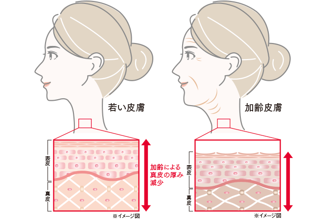 よく動かす「手」「首元」は特にシワが現れやすくなります。