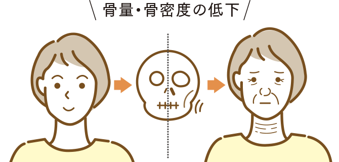 骨量・骨密度の低下