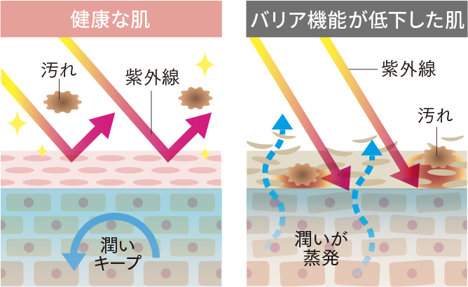 健康な肌とバリア機能が低下した肌