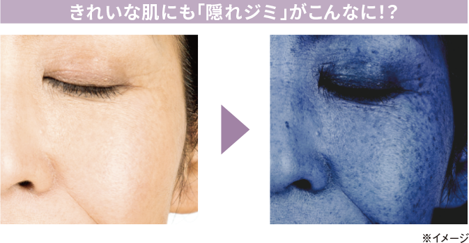 きれいな肌にも「隠れジミ」がこんなに!?