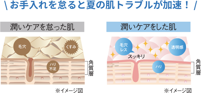 お手入れを怠ると夏の肌トラブルが加速!
