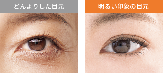 どんよりした目元／明るい印象の目元の比較図