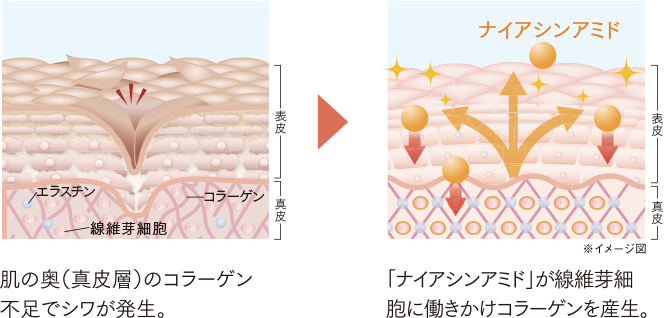 シワの改善のイメージ肌図