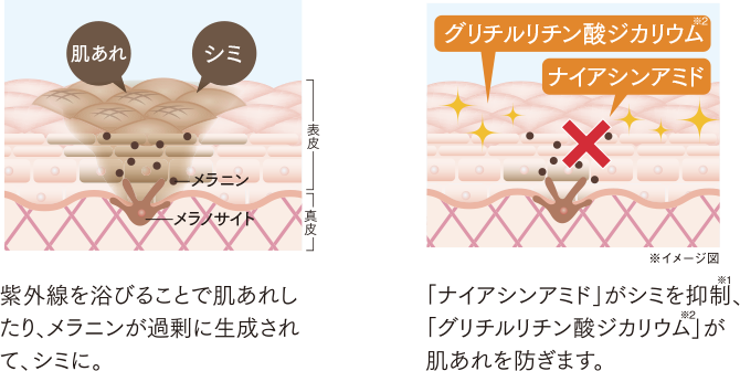 シミ・肌あれ対策を防ぐイメージ肌図