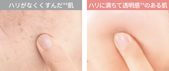 ハリがなくくすんだ肌とハリに満ちて透明感のある肌の比較
