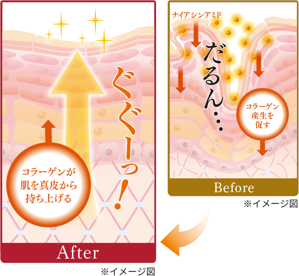 真皮のシワの改善イメージ