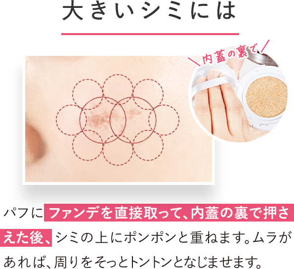 大きなシミには…？