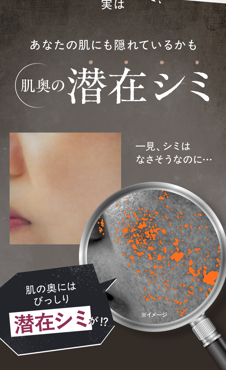 あなたの肌にも隠れているかも…肌奥の潜在シミ