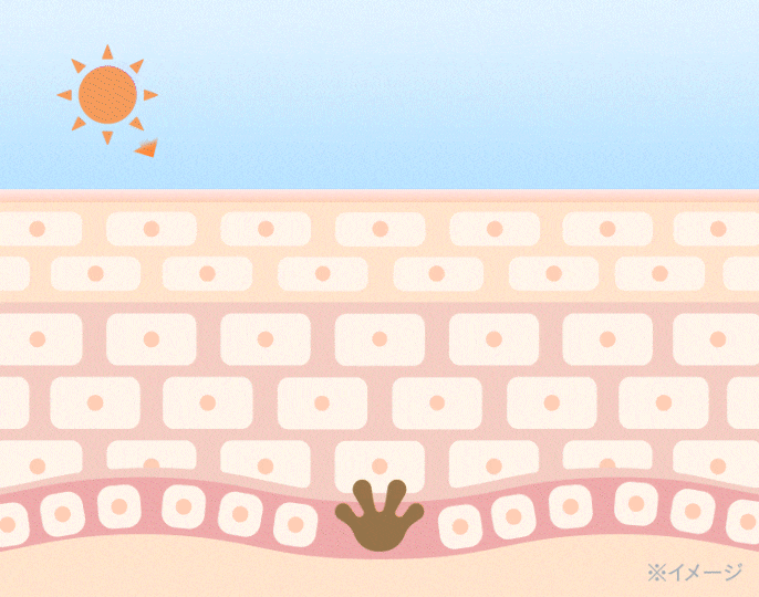 紫外線によるメラニン生成と肌荒れの仕組みに美容成分がアプローチする様子を示したイメージ図