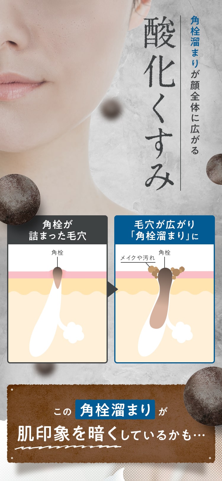角栓溜まりが顔全体に広がる 酸化くすみ 角栓溜まりが肌印象を暗くしているかも…