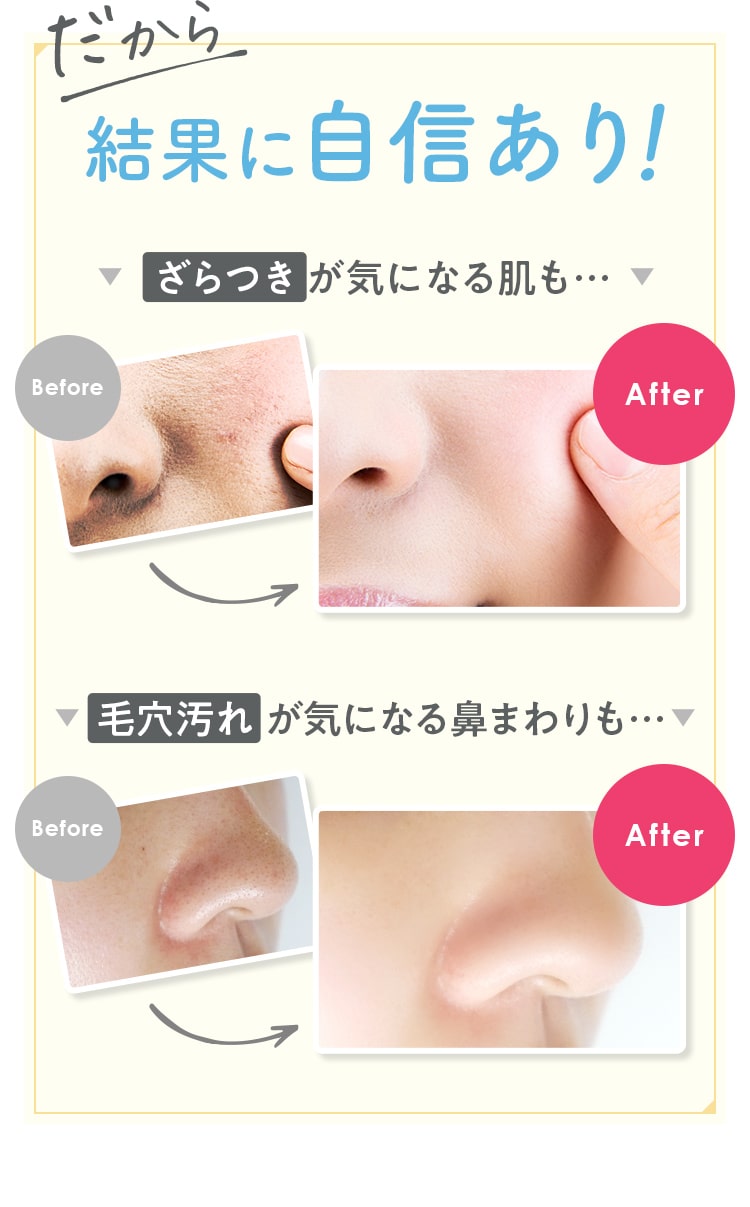 だから結果に自信あり！ざらつきが気になる肌も…毛穴汚れが気になる鼻まわりも…