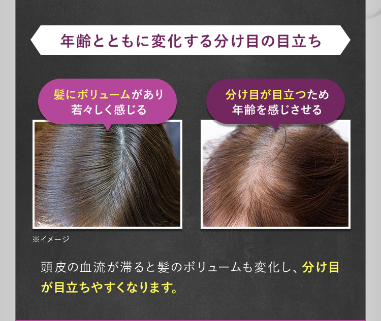 年齢とともに変化する分け目の目立ち 髪にボリュームがあり若々しく感じる 分け目が目立つため年齢を感じさせる ※イメージ 頭皮の血流が滞ると髪のボリュームも変化し、分け目が目立ちやすくなります。